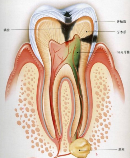 风火牙疼