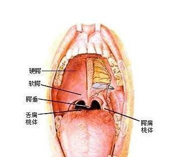 过敏性咽炎症状