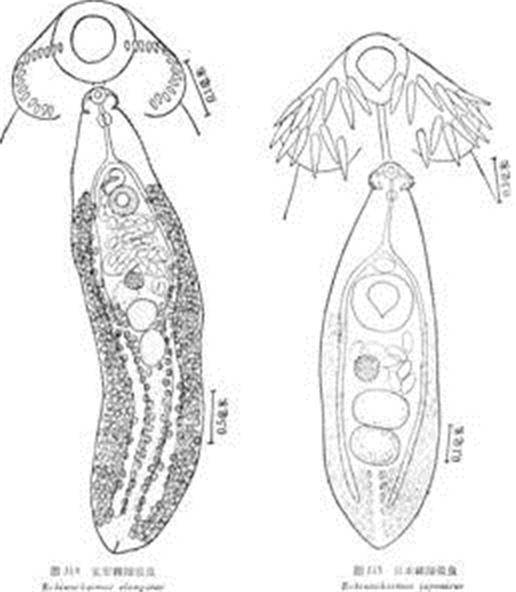 长形棘隙吸虫