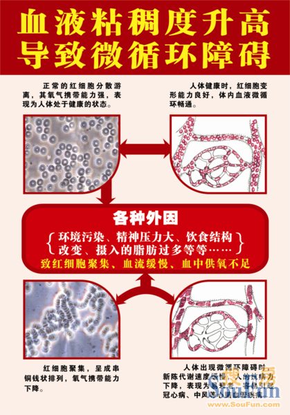 高血粘