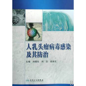 人乳头瘤病毒感染及其防治