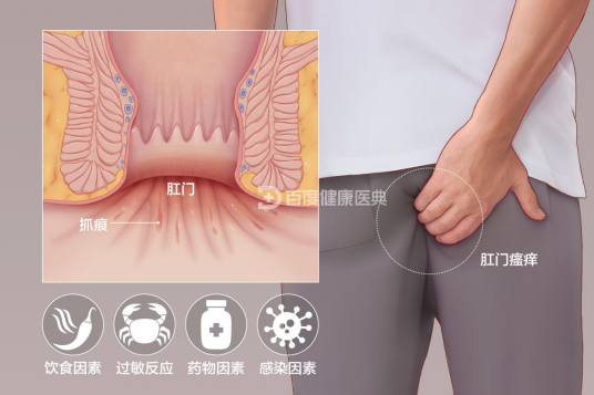 肛门瘙痒症