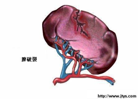 突发性血小板减少